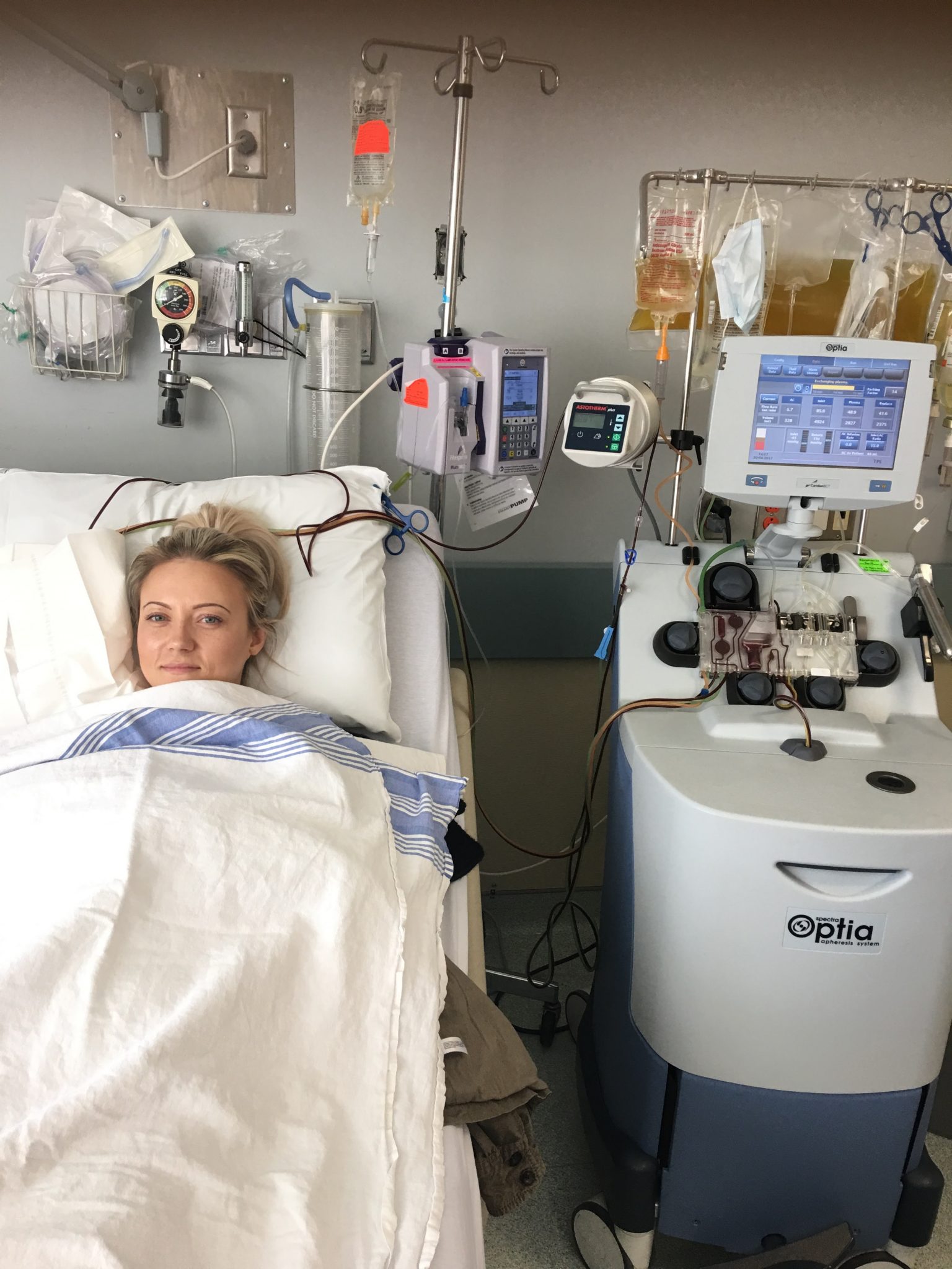 Myasthenia Gravis Rare Disease Day 2024